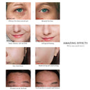 Sérums Profesional Niacinamida — Renovación & Hidratación