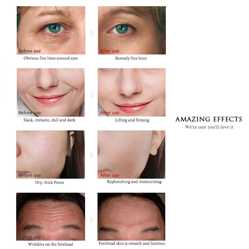 Sérums Profesional Niacinamida — Renovación & Hidratación